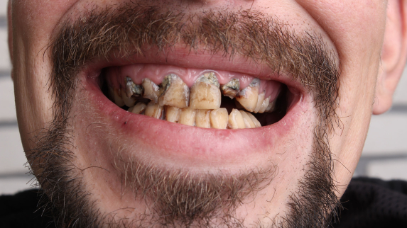 Tracking Firearm Violence and Impact on Dental Health.