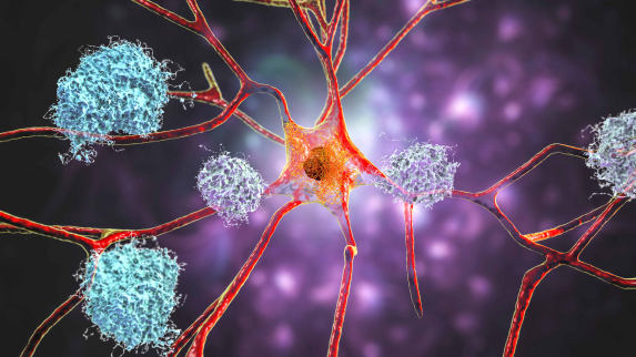 FDA Clears First Blood Test for Alzheimer’s Diagnosis, a “Turning Point” in Early Detection.