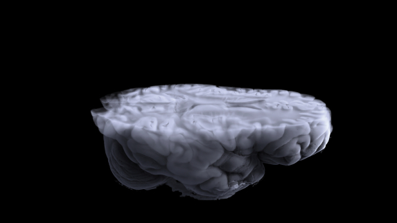 Rutgers and RWJBarnabas Health Receive $2.8 Million to Develop New Devices to Treat Epilepsy.