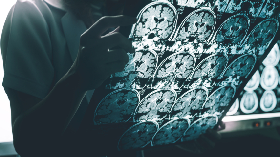 Alzheimer’s Research Center Receives $1.5 Million to Launch Physician-Scientist Program.