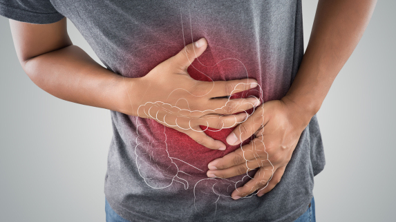 Inflammatory Bowel Disease Varies by Race, Sex and Birthplace, Researchers Find.