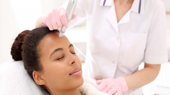 Microneedling Beats Chemical Peels for Acne Scar Treatment.