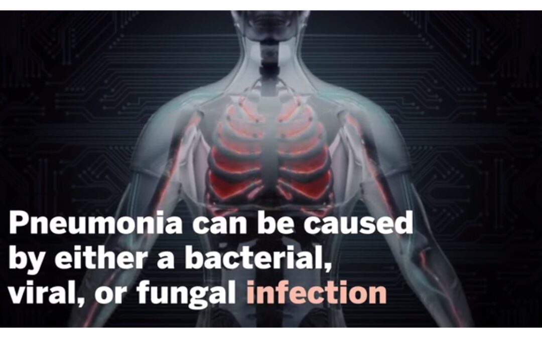 Is Pneumonia Contagious? What to Know, and How to Protect Yourself.