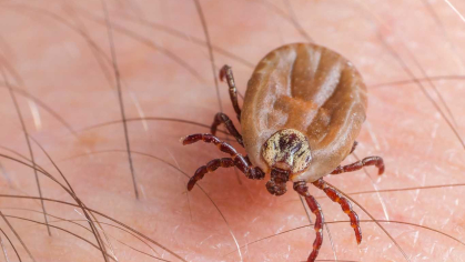 Decoding Early Lyme Disease.